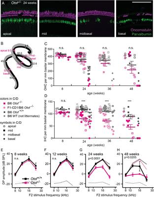 Otoferlin Is Required for Proper Synapse Maturation and for Maintenance of Inner and Outer Hair Cells in Mouse Models for DFNB9